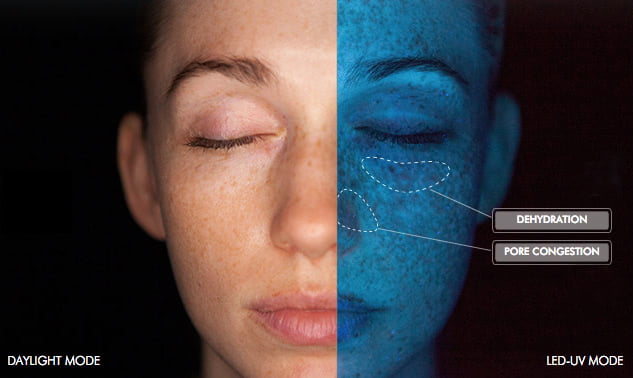 SkinCeuticals SkinScope LED