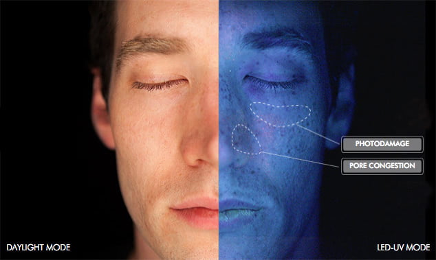 SkinCeuticals SkinScope LED