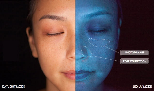 SkinCeuticals SkinScope LED
